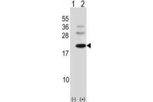 Western Blotting (WB) image for anti-BARX Homeobox 1 (BARX1) antibody (ABIN2998377) (BARX1 抗体)