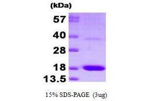 Figure annotation denotes ug of protein loaded and % gel used. (PTS Protein (AA 1-145) (His tag))
