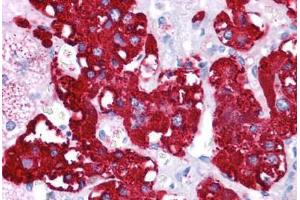 Human Adrenal: Formalin-Fixed, Paraffin-Embedded (FFPE)