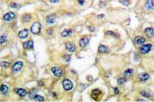 Image no. 1 for anti-Fibroblast Growth Factor Receptor 2 (FGFR2) antibody (ABIN265417) (FGFR2 抗体)