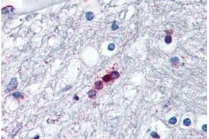 Human Brain, Oligodendrocytes (formalin-fixed, paraffin-embedded) stained with MBP antibody ABIN307190 at 5 ug/ml followed by biotinylated anti-mouse IgG secondary antibody ABIN481714, alkaline phosphatase-streptavidin and chromogen. (MBP 抗体  (AA 130-136))