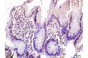 Formalin-fixed and paraffin embedded rat colon labeled with Anti-FOXN1 Polyclonal Antibody, Unconjugated (ABIN1387592) at 1:200 followed by conjugation to the secondary antibody and DAB staining (FOXN1 抗体  (AA 321-420))