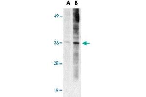 Western blot analysis of ST3GAL6 in HeLa cell lysate with ST3GAL6 polyclonal antibody  at (A) 1 and (B) 2 ug/mL . (ST3GAL6 抗体  (C-Term))