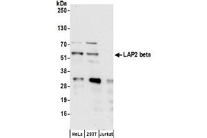 Western Blotting (WB) image for anti-LAP2 beta gamma/tmpo (AA 404-454) antibody (ABIN7453457) (LAP2 beta gamma/tmpo (AA 404-454) 抗体)