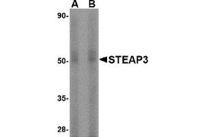 Western Blotting (WB) image for anti-STEAP Family Member 3, Metalloreductase (STEAP3) (N-Term) antibody (ABIN1031588) (STEAP3 抗体  (N-Term))