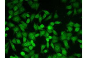 Immunofluorescent staining of HeLa cells with Glo1 monoclonal antibody, clone 6F10 . (GLO1 抗体)