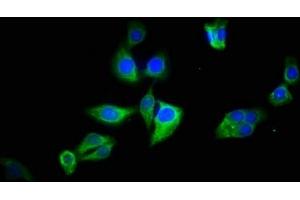 Immunofluorescence staining of HepG2 cells with ABIN7145113 at 1:133, counter-stained with DAPI. (ATG2B 抗体  (AA 1357-1536))
