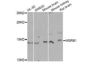 Western blot analysis of extracts of various cell lines, using MSRB1 Antibody (ABIN2559877) at 1:1000 dilution. (MSRB1 抗体)
