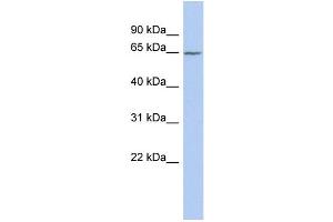 WB Suggested Anti-SLC25A12 Antibody Titration:  0. (SLC25A12 抗体  (Middle Region))