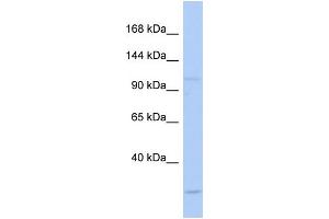 Western Blotting (WB) image for anti-N(alpha)-Acetyltransferase 15, NatA Auxiliary Subunit (NAA15) (N-Term) antibody (ABIN2783595)