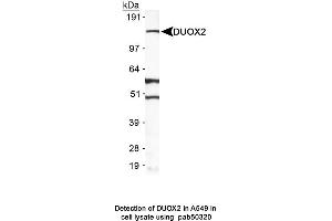 Image no. 1 for anti-Dual Oxidase 2 (DUOX2) (AA 400-500) antibody (ABIN363629) (DUOX2 抗体  (AA 400-500))