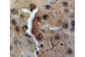 Used in DAB staining on fromalin fixed paraffin-embedded Brain tissue (FKBP3 抗体  (AA 2-224))