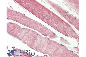 ABIN5539899 (5µg/ml) staining of paraffin embedded Human Skeletal Muscle. (THNSL2 抗体  (AA 192-204))