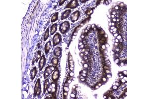 IHC testing of FFPE rat small intestine tissue with Glutathione Reductase antibody at 1ug/ml. (Glutathione Reductase 抗体)