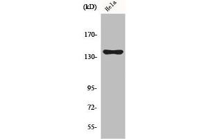 Western Blot analysis of COLO205 cells using KIF4A Polyclonal Antibody (KIF4A 抗体  (C-Term))