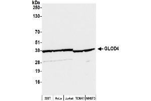 anti-Glyoxalase Domain Containing 4 (GLOD4) (AA 263-313) antibody
