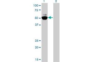 Western Blotting (WB) image for anti-N-Myc Proto-Oncogene Protein (MYCN) (AA 1-100) antibody (ABIN561893)