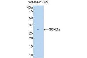 Western Blotting (WB) image for anti-Carbonic Anhydrase II (CA2) (AA 5-258) antibody (ABIN1858211) (CA2 抗体  (AA 5-258))