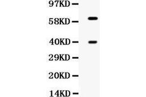 Western blot analysis of TPP1 expression in HELA whole cell lysates (lane 1). (TPP1 抗体  (Middle Region))