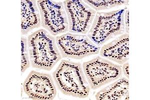 Immunohistochemistry of paraffin embedded mouse small intestine using ZC3H11A (ABIN7076255) at dilution of 1: 6000 (300x lens)