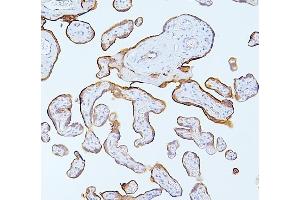 IHC analysis of MMP1 using anti-MMP1 antibody (ABIN7599873). (MMP1 抗体  (AA 124-469))