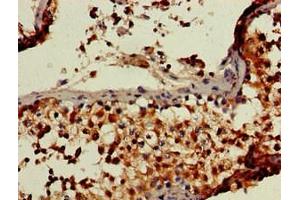 Immunohistochemistry (IHC) image for anti-Retinoblastoma Binding Protein 6 (RBBP6) (AA 51-97) antibody (ABIN7151111)