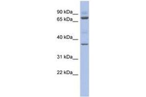 Image no. 1 for anti-Metal Response Element Binding Transcription Factor 2 (MTF2) (AA 359-408) antibody (ABIN6742455) (MTF2 抗体  (AA 359-408))