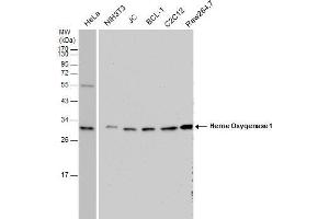 WB Image Heme Oxygenase 1 antibody detects Heme Oxygenase 1 protein by western blot analysis.