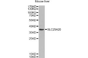 Western blot analysis of extracts of mouse liver, using SLC25A20 Antibody (ABIN6291312) at 1:1000 dilution. (SLC25A20 抗体)