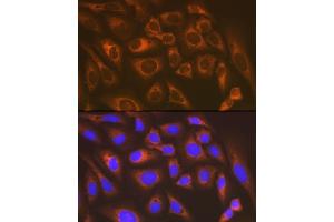 Immunofluorescence analysis of U-2 OS cells using LysRS/KARS Rabbit mAb (ABIN7268350) at dilution of 1:100 (40x lens). (KARS 抗体)