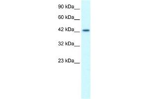 Human Jurkat; WB Suggested Anti-LHX3 Antibody Titration: 1. (LHX3 抗体  (Middle Region))