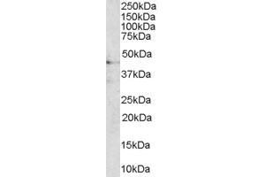 Western Blotting (WB) image for anti-AT-Hook Transcription Factor (AKNA) (C-Term) antibody (ABIN2790351) (AKNA 抗体  (C-Term))