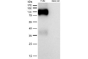 Western Blotting (WB) image for anti-Low Density Lipoprotein Receptor-Related Protein 8, Apolipoprotein E Receptor (LRP8) antibody (ABIN7606978)