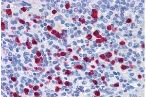 Human Spleen: Formalin-Fixed, Paraffin-Embedded (FFPE) (GCC2 抗体  (AA 1174-1185))