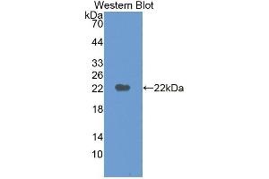 Detection of Recombinant M6PR, Human using Polyclonal Antibody to Mannose-6-Phosphate Receptor (M6PR) (M6PR 抗体  (AA 27-185))