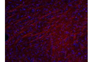 Indirect immunostaining of PFA fixed mouse brain section (dilution 1 : 500; red). (MBP 抗体)