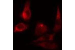 ABIN6275492 staining LOVO cells by IF/ICC. (ARHGAP9 抗体  (Internal Region))