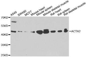 Western blot analysis of extracts of various cell lines, using ACTA2 antibody. (Smooth Muscle Actin 抗体  (AA 1-124))