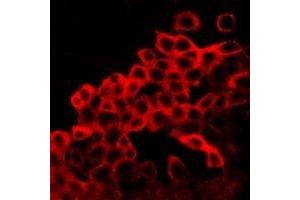 Immunofluorescent analysis of BAX staining in LOVO cells. (BAX 抗体  (C-Term))
