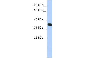 WB Suggested Anti-LHX3 Antibody Titration:  0.