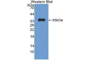 Western Blotting (WB) image for anti-Plakophilin 2 (PKP2) (AA 571-849) antibody (ABIN2119569) (Plakophilin 2 抗体  (AA 571-849))