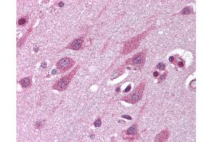 Anti-TMED10 / TMP21 antibody IHC of human brain, cortex. (TMED10 抗体  (Internal Region))