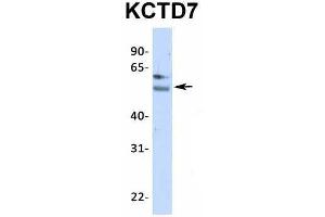 Western Blotting (WB) image for anti-Potassium Channel Tetramerisation Domain Containing 7 (KCTD7) (N-Term) antibody (ABIN2776287)