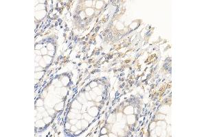 Immunohistochemistry (IHC) image for anti-Interleukin 21 (IL21) (AA 25-162) antibody (ABIN6142359)