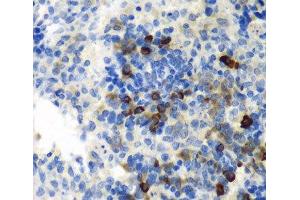Immunohistochemistry of paraffin-embedded Rat spleen using AIMP1 Polyclonal Antibody at dilution of 1:100 (40x lens). (AIMP1 抗体)