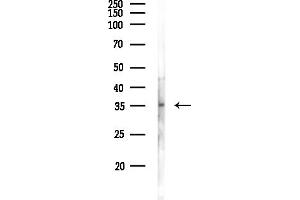 anti-Heterogeneous Nuclear Ribonucleoprotein C (C1/C2) (HNRNPC) (C-Term) antibody