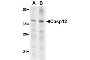 Western blot analysis of caspase-12 in mouse (lane A) and rat (lane B) liver lysate with AP30193PU-N caspase-12 antibody (small) at 1 μg/ml.