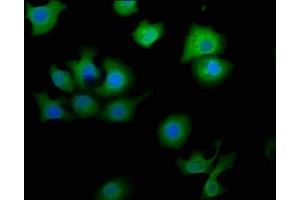 Immunofluorescence staining of A549 cells with ABIN7160660 at 1:50, counter-stained with DAPI. (MTMR9 抗体  (AA 322-549))