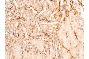 ABIN6267073 at 1/100 staining mouse kidney tissue sections by IHC-P. (CHEK1 抗体  (pSer280))