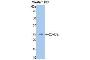 Detection of Recombinant HMWK, Human using Polyclonal Antibody to High Molecular Weight Kininogen (HMWK) (Kininogen (HMW) 抗体  (AA 225-407))